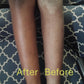 Eczema Cream